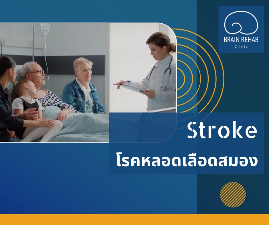 โรคหลอดเลือดสมอง (Stroke) คืออะไร