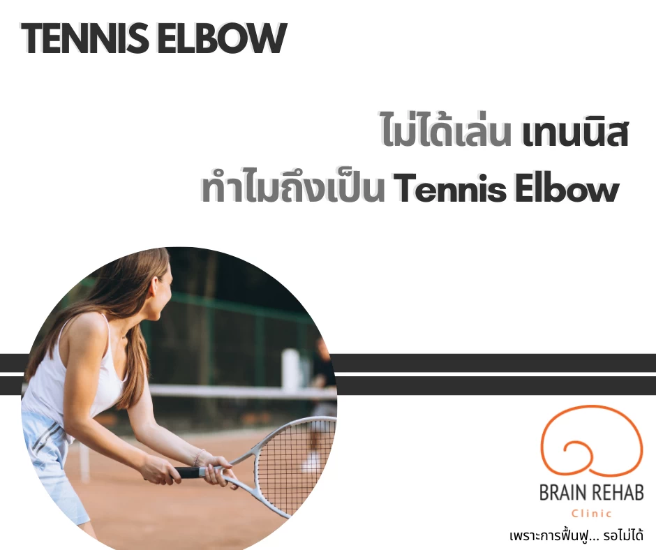 โรคเอ็นข้อศอกอักเสบ (Tennis Elbow) คืออะไร