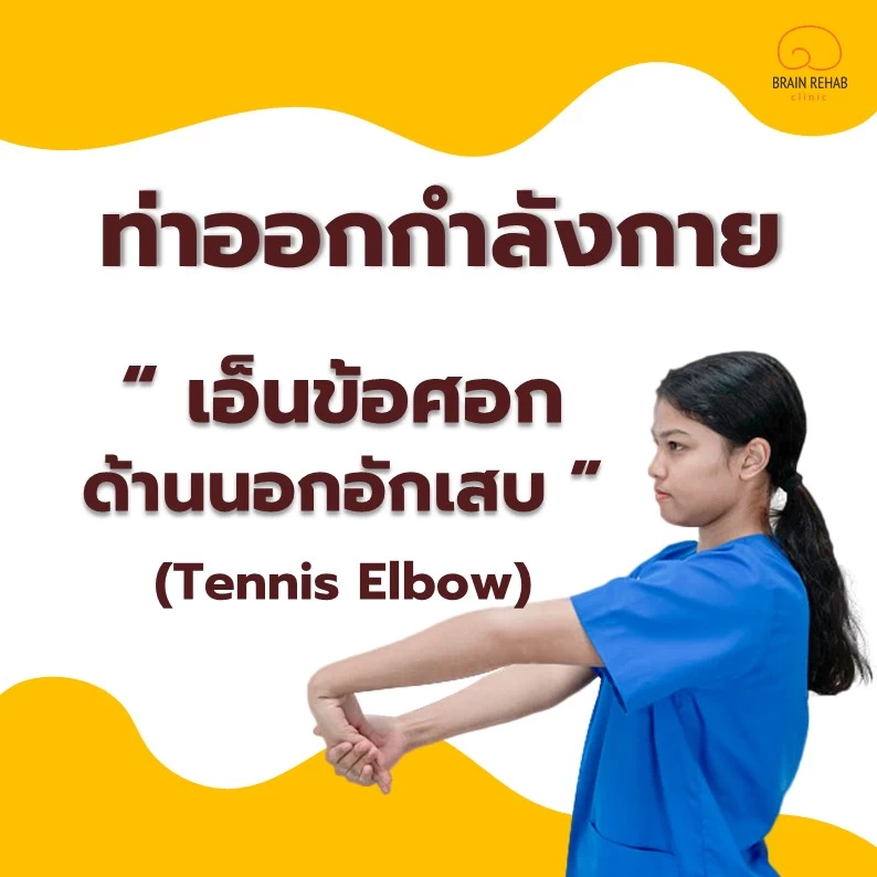 ท่าออกกำลังกาย โรคเอ็นข้อศอกอักเสบ (Tennis Elbow)