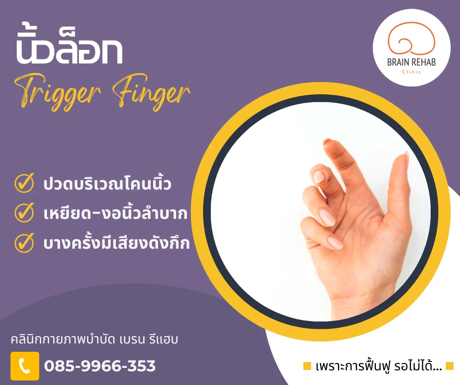 นิ้วล็อก (Trigger Finger) คืออะไร