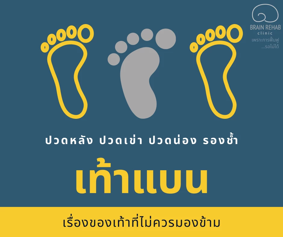 เท้าแบน (Flat Foot) คืออะไร