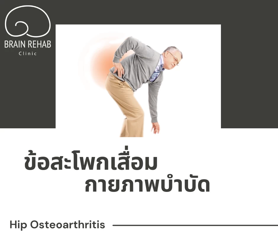 ข้อสะโพกเสื่อม (Hip Osteoarthritis) คืออะไร