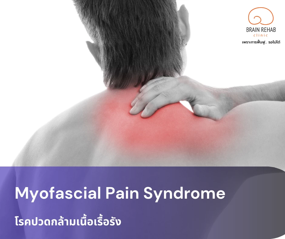 โรคปวดกล้ามเนื้อเรื้อรัง (Myofascial Pain Syndrome) คืออะไร