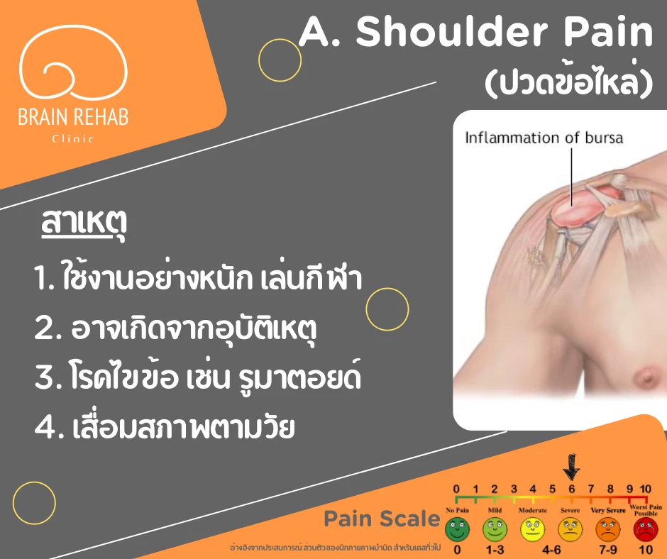 สาเหตุของอาการปวดไหล่ (Shoulder Pain) รวมถึงวิธีการดูแลตัวเองเบื้องต้น