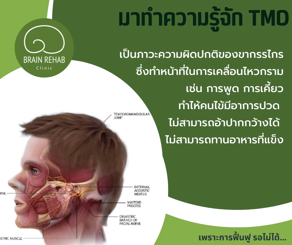 สาเหตุของ Temporomandibular Disorders (TMD, TMJ) เกิดจากอะไร