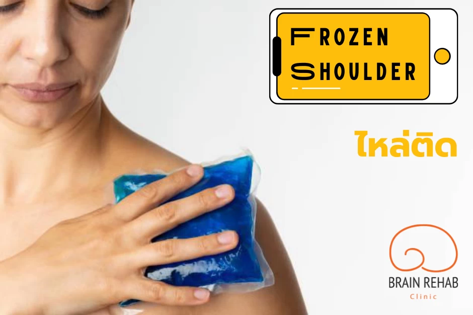 ไหล่ติด (Frozen Shoulder) คืออะไร