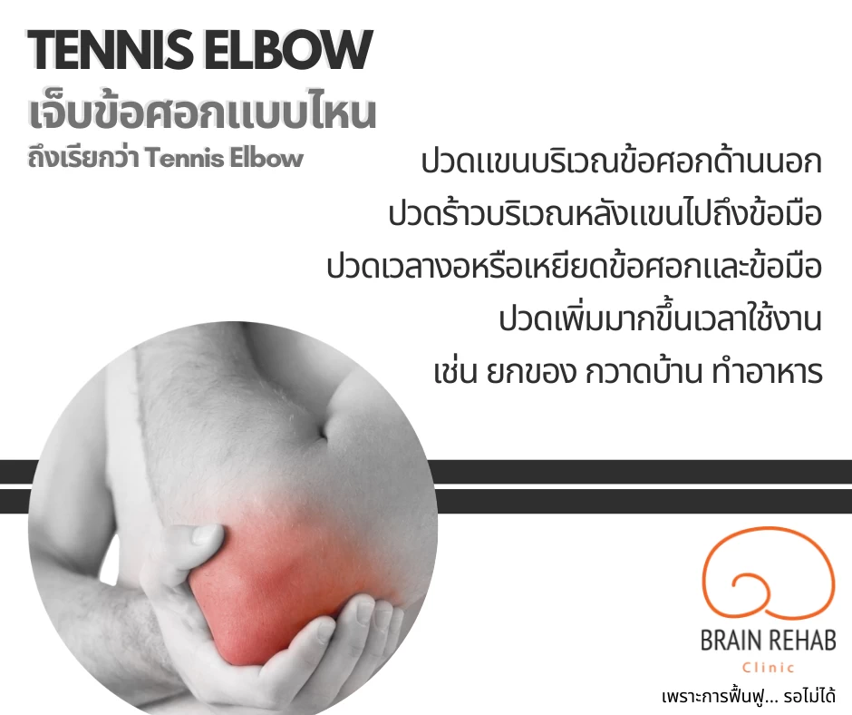 อาการของโรคเอ็นข้อศอกอักเสบ (Tennis Elbow)