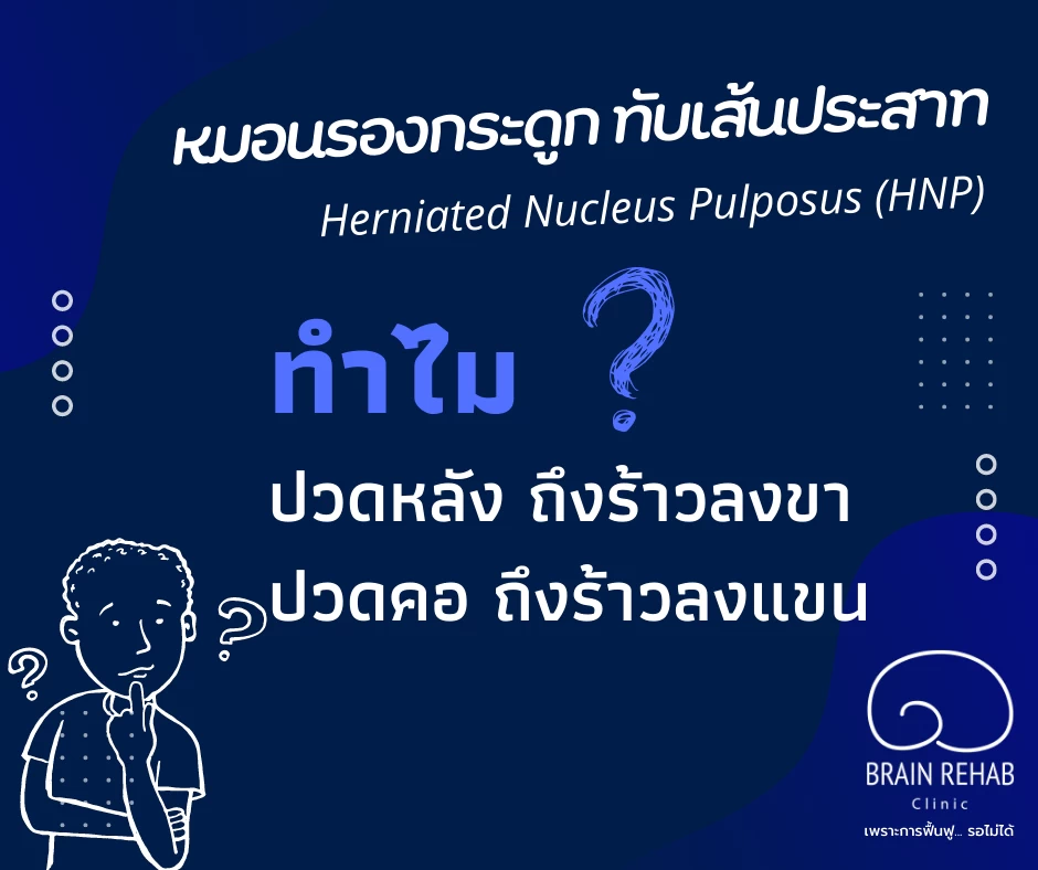 หมอนรองกระดูกทับเส้นประสาท (HNP) คืออะไร
