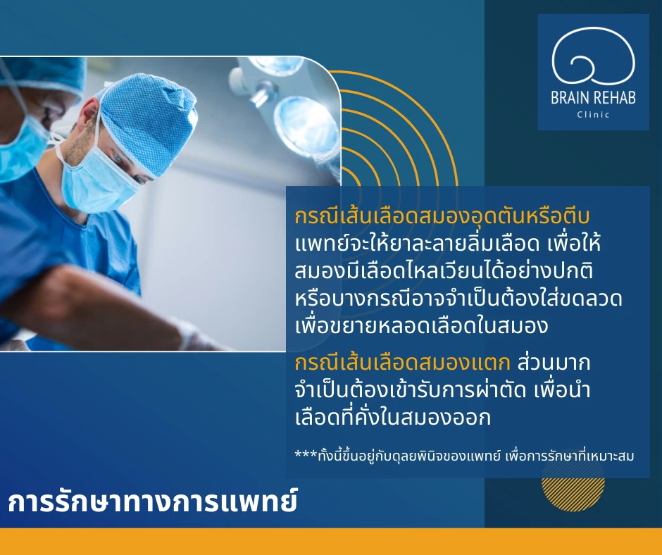 การรักษาโรคหลอดเลือดสมอง (Stroke) ทางการแพทย์