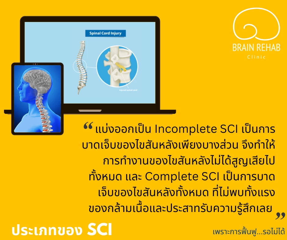 ประเภทของการบาดเจ็บไขสันหลัง (Spinal Cord Injury) แบ่งเป็นอะไรบ้าง