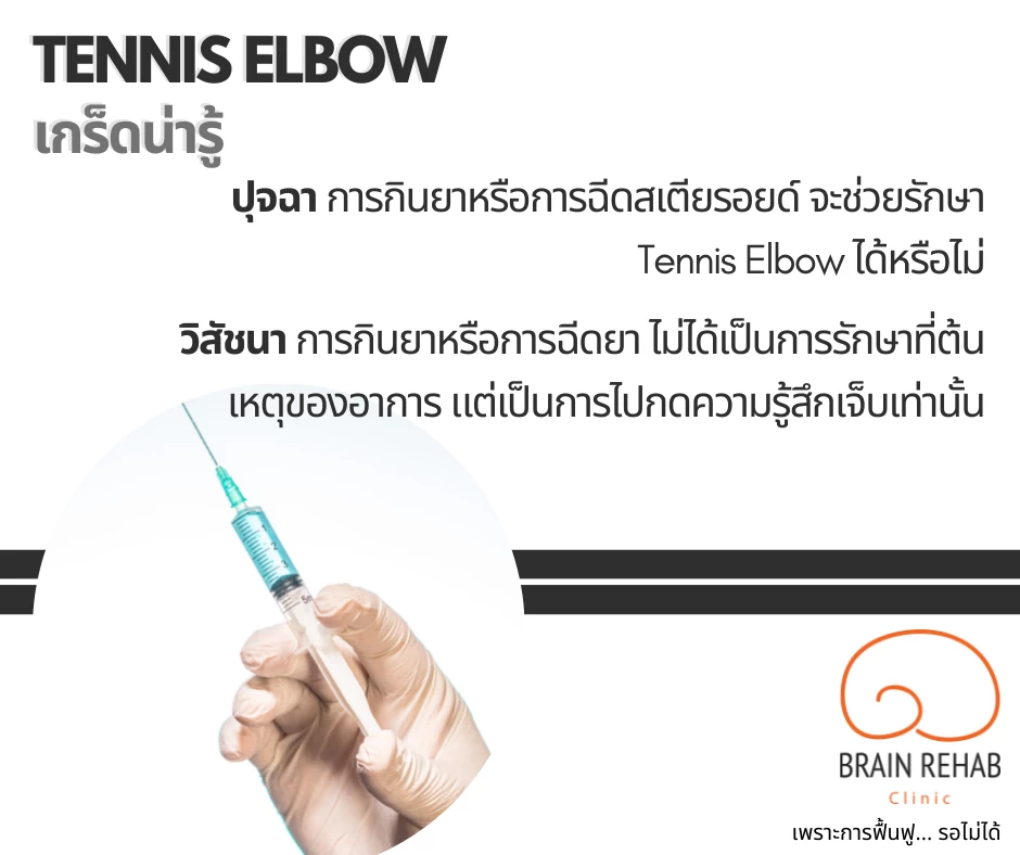 การกินยา การฉีดยา โรคเอ็นข้อศอกอักเสบ (Tennis Elbow)