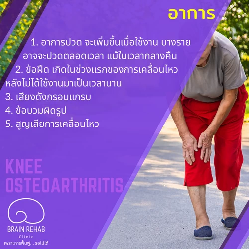 อาการของโรคข้อเข่าเสื่อม มีอะไรบ้าง (Knee Osteoarthritis อาการ, OA Knee อาการ)