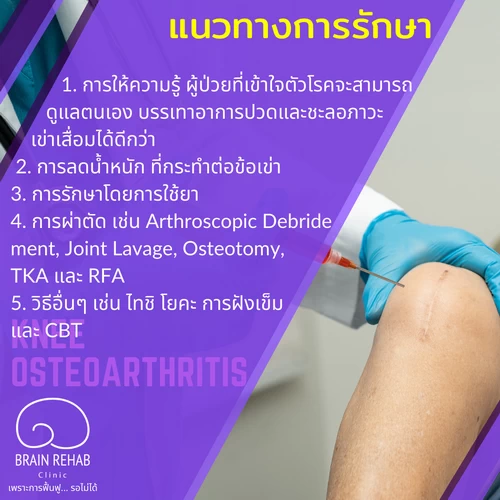 การรักษาโรคข้อเข่าเสื่อม มีกี่แบบ อะไรบ้าง (Knee Osteoarthritis รักษา, OA Knee รักษา)