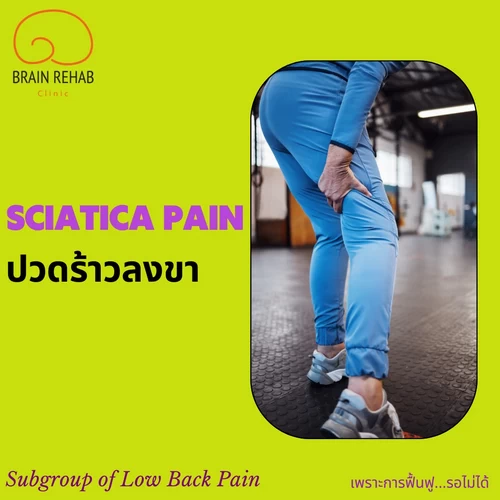 ปวดร้าวลงขา (Sciatica Pain) ทำไมปวดหลัง ปวดสะโพก ถึงร้าวลงขา