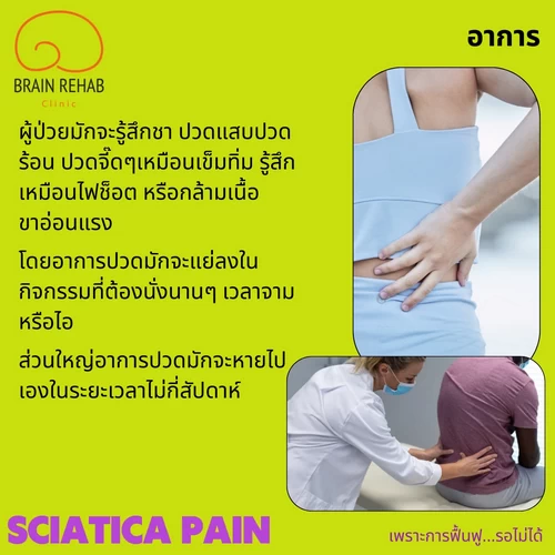 อาการปวดร้าวลงขา เป็นยังไง (Sciatica pain อาการ)