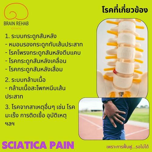 โรคที่เกี่ยวข้องกับอาการปวดร้าวลงขา มีอะไรบ้าง (Sciatica pain โรค) ปวดร้าวลงขาเป็นโรคอะไร