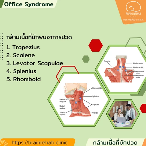 กล้ามเนื้อที่เกิดอาการปวดเป็นประจำ สำหรับโรคออฟฟิศซินโดรม (office syndrome muscle)