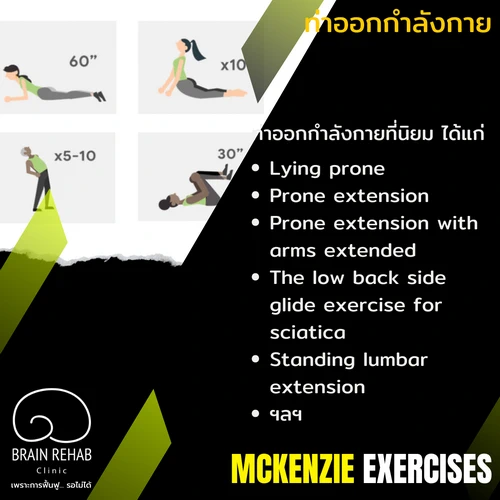 ท่าออกกำลังกายแบบแมคเคนซี่ (McKenzie Exercises)