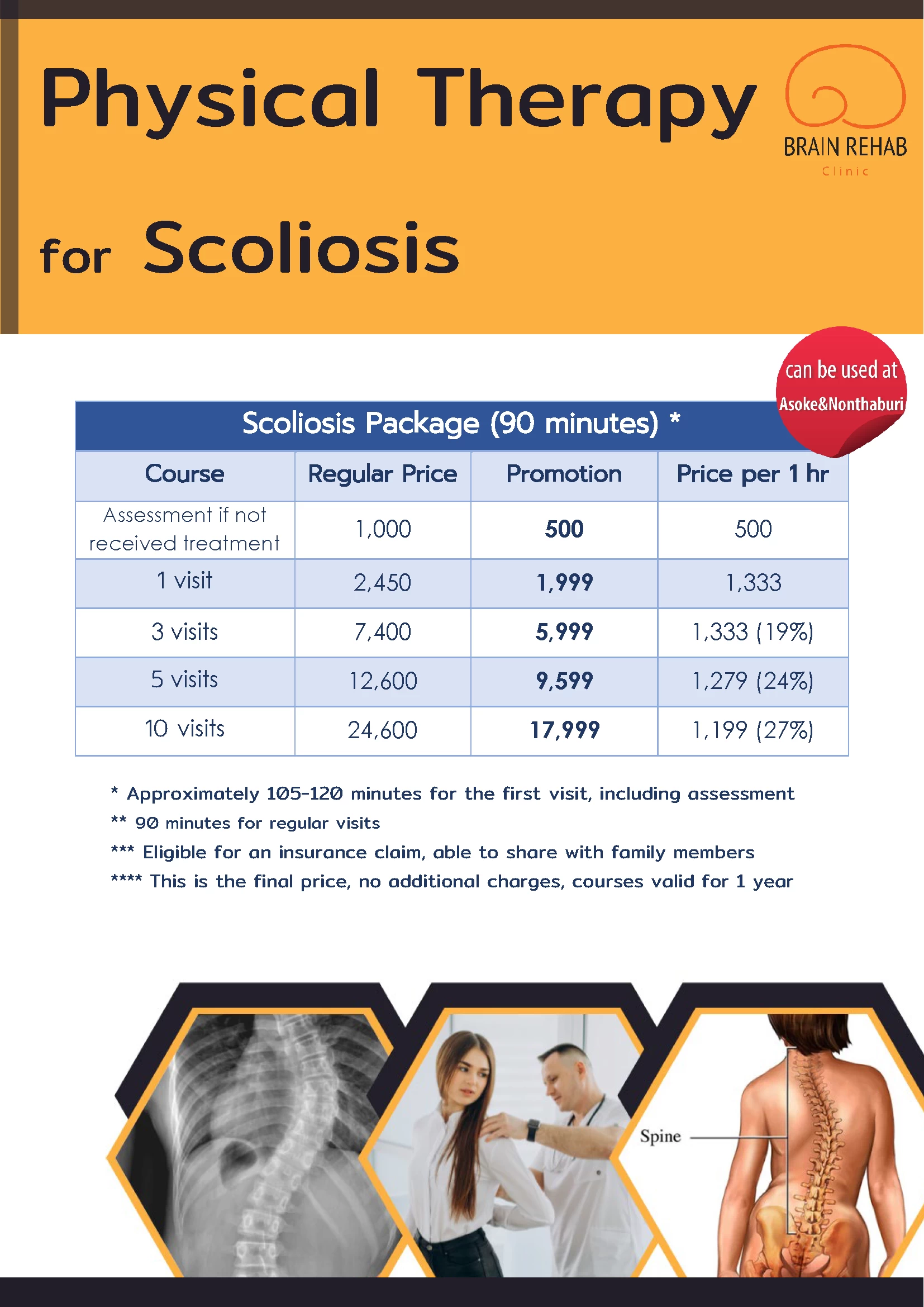 Scoliosis Program Costs | Brain Rehab Physical Therapy Clinic