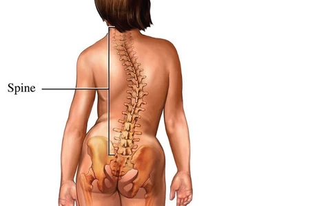 scoliosis and spine rehab content