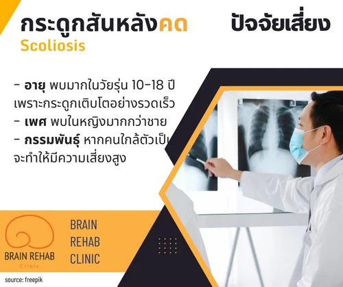 ปัจจัยเสี่ยงที่ทำให้เป็นโรคกระดูกสันหลังคด (Scoliosis)
