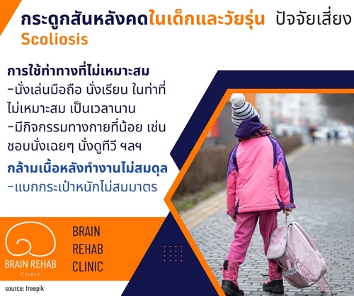 วิธีป้องกันกระดูกสันหลังคด (Scoliosis) ในเด็กและวัยรุ่น