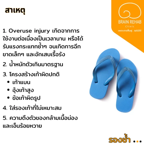 สาเหตุของโรครองช้ำ (Plantar Fasciitis) มีอะไรบ้าง