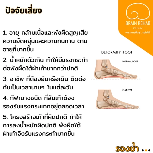 ปัจจัยเสี่ยงในการเกิดโรครองช้ำ (Plantar Fasciitis) มีอะไรบ้าง