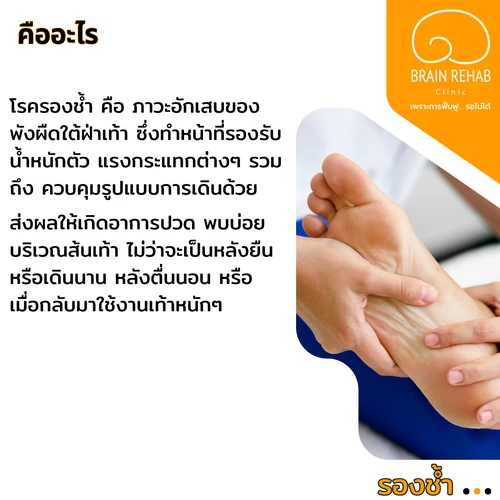 โรครองช้ำ (Plantar Fasciitis) คืออะไร โรครองช้ำ (Plantar Fasciitis) เป็นภาวะการอักเสบหรือความเสื่อมสภาพของพังผืดใต้ฝ่าเท้า (Plantar Fascia)