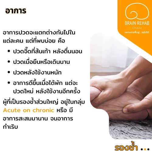 อาการของโรครองช้ำ (Plantar Fasciitis) มีอะไรบ้าง