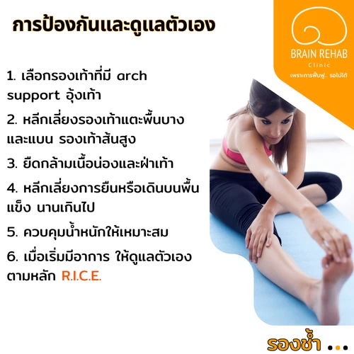 วิธีการดูแลตัวเอง เพื่อป้องกันการเกิดโรครองช้ำ (Plantar Fasciitis) มีอะไรบ้าง
